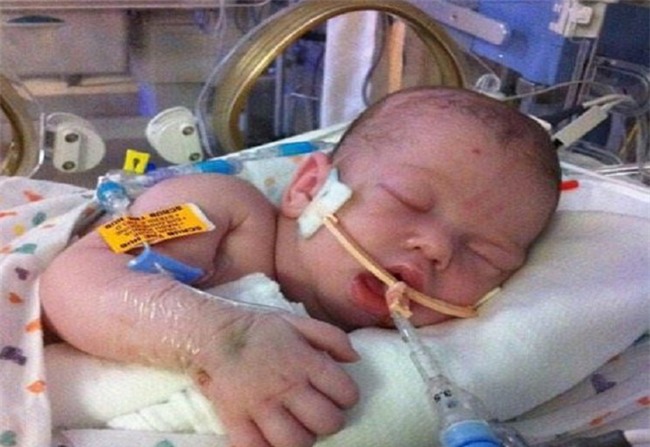 Bú mẹ suốt ngày nhưng bé 18 ngày tuổi vẫn chết đói: Nguyên nhân không ai ngờ tới - Ảnh 2.