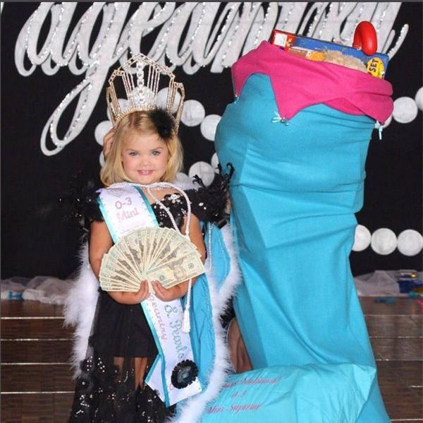 loat anh cho thay su doi doi cua "hoa hau nhi" nuoc my tung phai tiem botox 3 thang/lan - 1