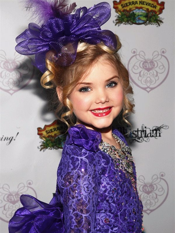 loat anh cho thay su doi doi cua "hoa hau nhi" nuoc my tung phai tiem botox 3 thang/lan - 2