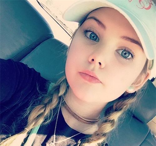 loat anh cho thay su doi doi cua "hoa hau nhi" nuoc my tung phai tiem botox 3 thang/lan - 3