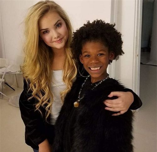 loat anh cho thay su doi doi cua "hoa hau nhi" nuoc my tung phai tiem botox 3 thang/lan - 6