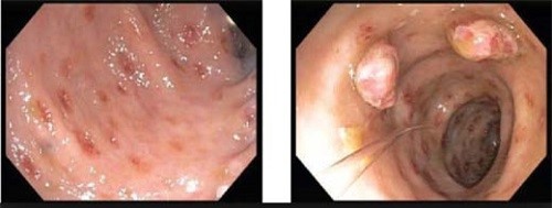 Nguoi phu nu chi con da boc xuong do nhiem giun luon hinh anh 1