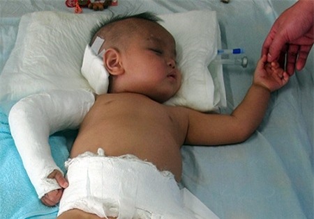 Rơi từ tầng 5, bé trai 15 tháng tuổi thoát chết thần kỳ - Ảnh 1