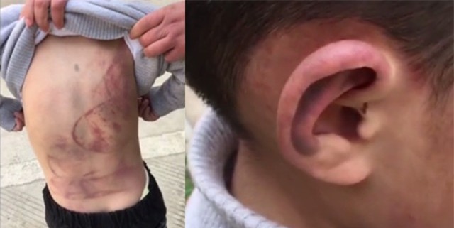 Cậu bé 6 tuổi không dám về nhà, ngủ gầm ô tô vì lý do khiến ai cũng phẫn nộ - Ảnh 1.