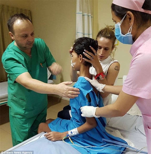 Thiếu nữ 18 tuổi bị phá hủy khuôn mặt sau khi nhổ 1 chiếc răng và đây là nguyên nhân - Ảnh 3.