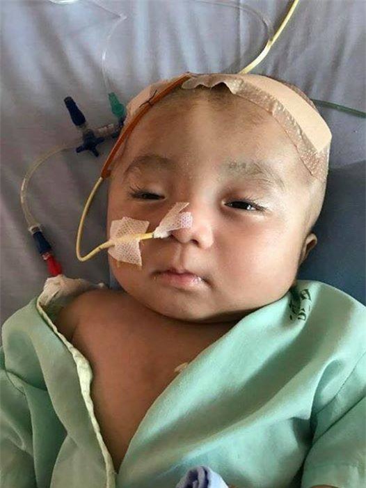Em bé não úng thuỷ bị bỏ rơi trước cổng chùa đã ngưng thuốc, không còn khả năng phẫu thuật tại Singapore - Ảnh 2.