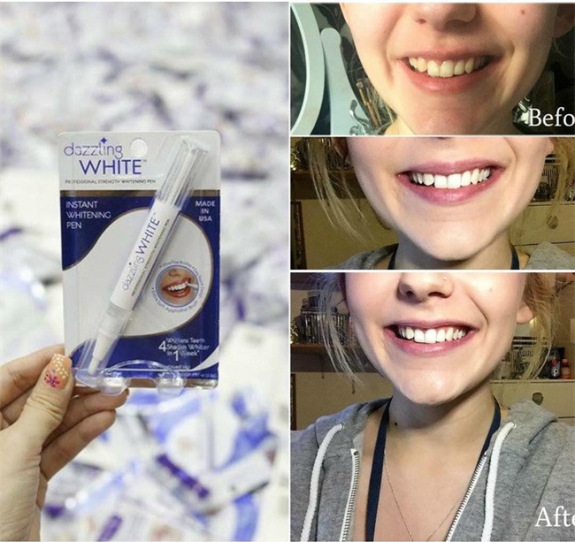 3 sản phẩm làm trắng răng rất tiện dụng bạn nên thử ngay tại nhà - Ảnh 8.