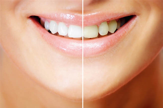 3 sản phẩm làm trắng răng rất tiện dụng bạn nên thử ngay tại nhà - Ảnh 9.