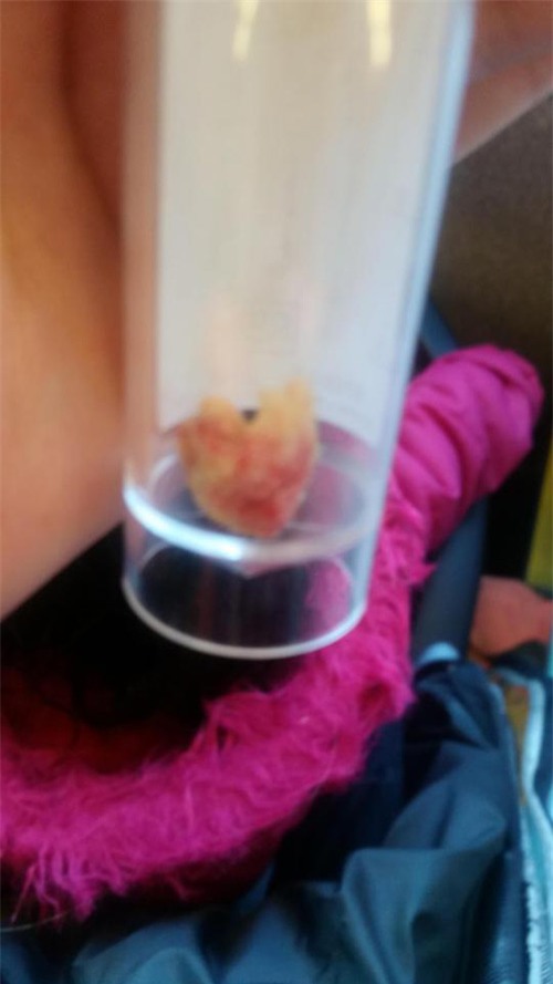 be 18 thang co mui hoi khong ai chiu noi, me bang hoang khi biet nguyen nhan - 2