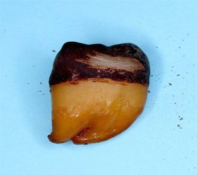 Nha sĩ Mỹ ngâm răng trong 3 thức uống đang được yêu thích hiện nay: Nhiều người tỉnh ngộ - Ảnh 1.