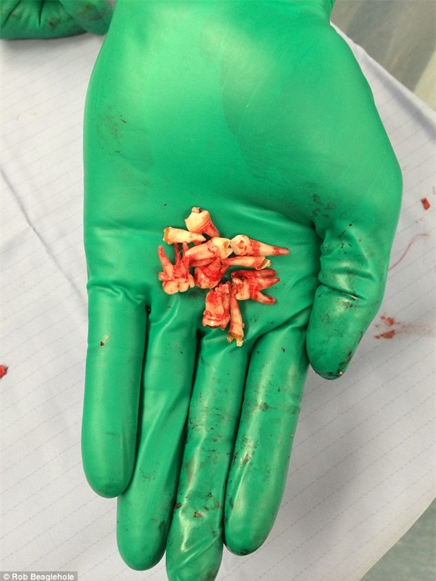 Nha sĩ Mỹ ngâm răng trong 3 thức uống đang được yêu thích hiện nay: Nhiều người tỉnh ngộ - Ảnh 5.