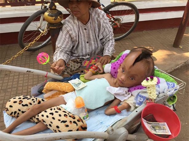 Bé trai đáng thương bị nứt đôi đầu mà không rõ nguyên do - Ảnh 1.