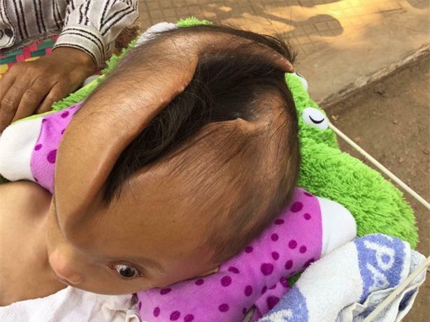 Bé trai đáng thương bị nứt đôi đầu mà không rõ nguyên do - Ảnh 2.