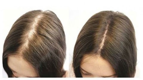 rụng tóc, chống rụng tóc, điều trị rụng tóc, rụng tóc sau sinh, kích thích tóc mọc nhanh, Vitamin, Vitamin B1