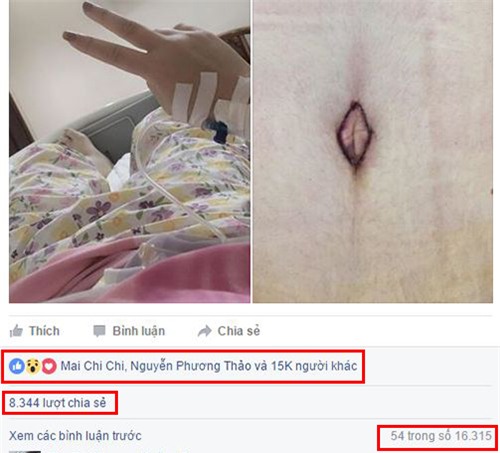 a quan buoc nhay ngan can thuy tien khoe anh cat mo bung gay soc - 2