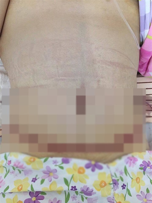 a quan buoc nhay ngan can thuy tien khoe anh cat mo bung gay soc - 3