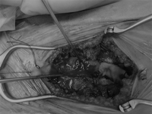 chu quan voi con dau lung am i, co gai tre “chet lang” khi bac sy doc ket qua - 1