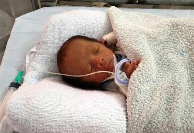 Cháu Nguyễn Văn Việt đang được điều trị tại Bệnh viện Sản - Nhi Ninh Bình.