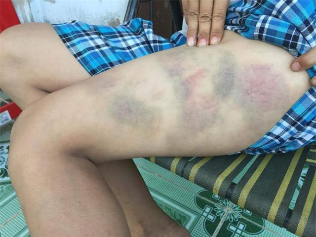 cha danh con giua duong, cong an phai giai cuu hinh anh 1