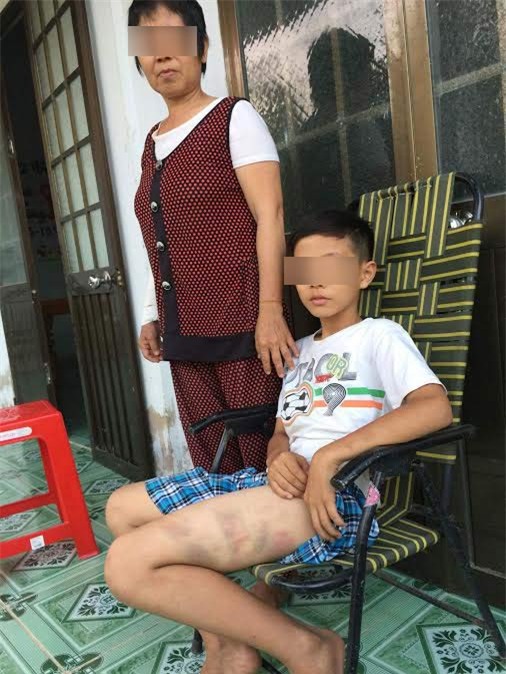 cha danh con giua duong, cong an phai giai cuu hinh anh 2