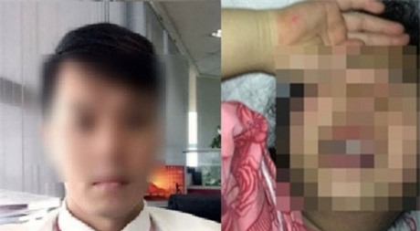 Hanh trinh buoc nghi can xam hai be gai o Hoang Mai tra tay vao cong - Anh 10