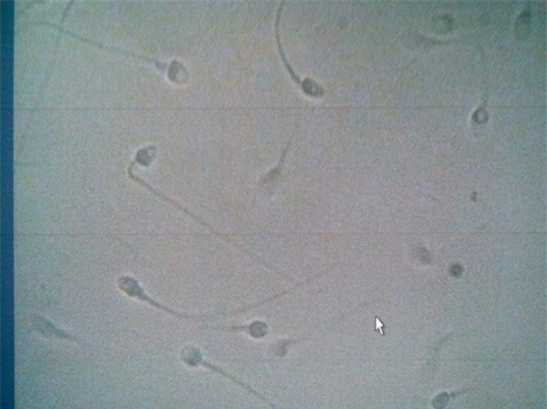 'thu dam' nhieu nam lien tuc, den khi sap lay vo, nam thanh nien 'sot xinh xich' di kham vo sinh - 2