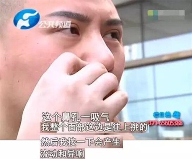 Chi gần 200 triệu đồng cắt mí mắt và nâng mũi để đẹp như hot boy, người đàn ông nhận cái kết đắng - Ảnh 6.