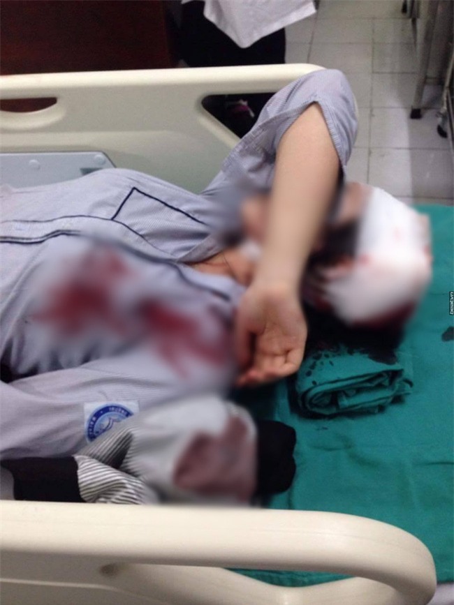 Xác định đối tượng dùng tuýp sắt chặn đánh nữ sinh lớp 10 sau giờ tan trường ở Hà Nội - Ảnh 1.
