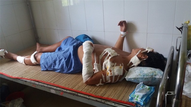 Anh Giang đang nằm điều trị tại bệnh viện với gần 20 vết khâu do bị chém. Ảnh: Minh Hào