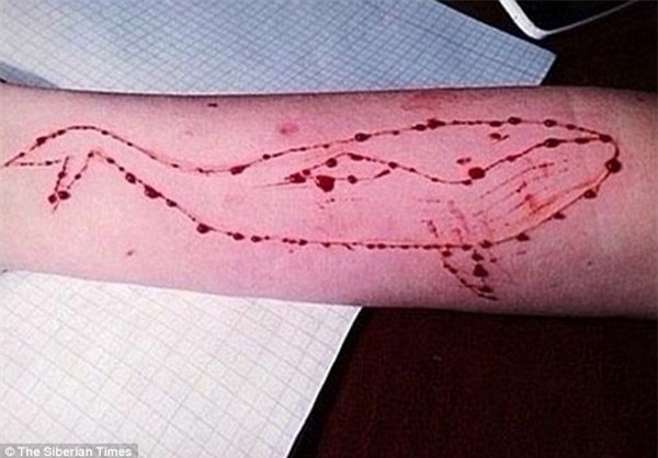 Các nữ sinh tham gia vào “trò chơi tự sát” trên mạng xã hội bị yêu cầu thực hiện những màn tự hành xác, bao gồm sử dụng dao để tạo nên hình vẽ cá voi trên tay hoặc chân của mình