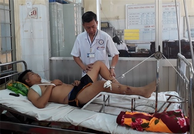 Canh sat co dong bi 'quai xe' tong xe chan thuong so nao hinh anh 1