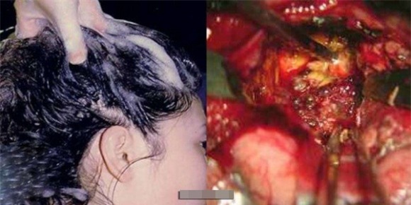 gội đầu, thời điểm không nên gội đầu, tránh gội đầu