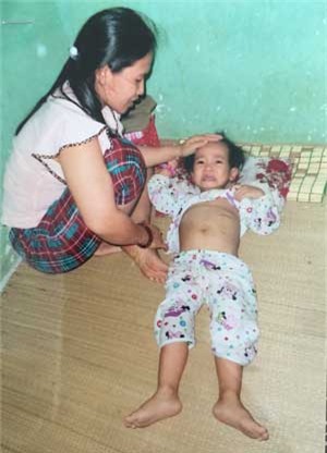 ung thư dạ dày, hóa trị, tế bào ung thư di căn