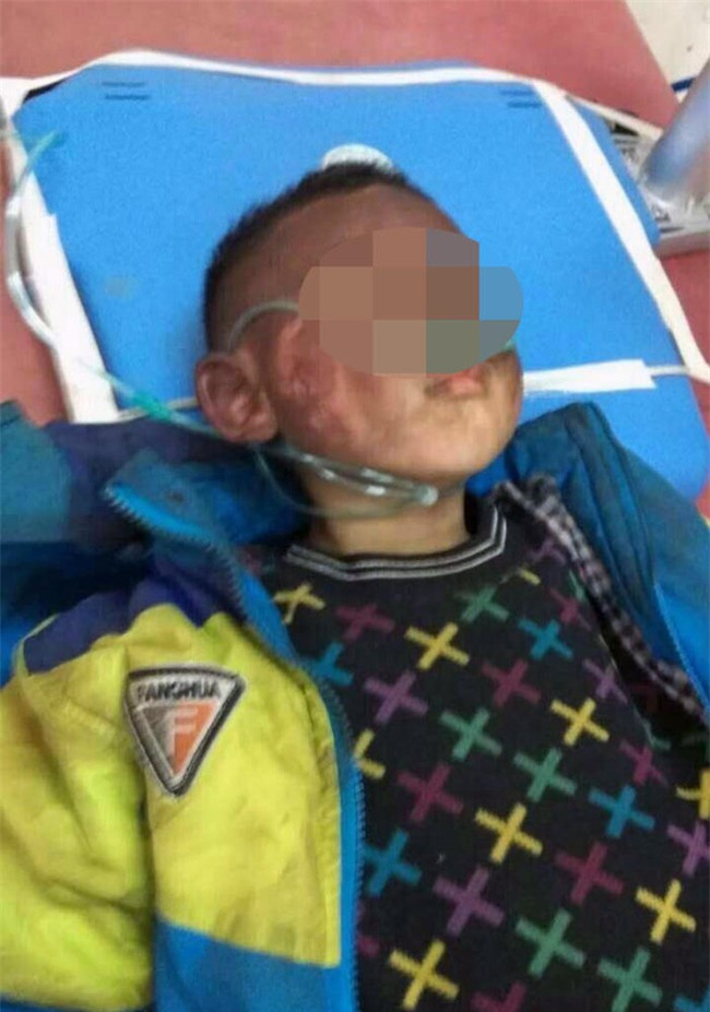 Trung Quốc: 2 đứa trẻ bị bỏ lại trong xe dùng bật lửa thiêu rụi cả chiếc Audi A6 - Ảnh 4.