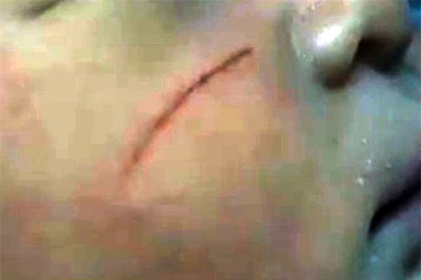 Bác sĩ sản khoa cắt cụt ngón tay trẻ sơ sinh khi mổ lấy thai - Ảnh 2.