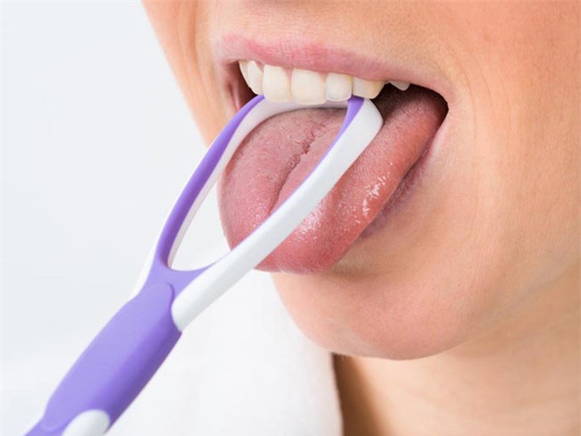 5 điều có thể xảy ra khi bạn quên vệ sinh lưỡi mỗi ngày! - Ảnh 2.
