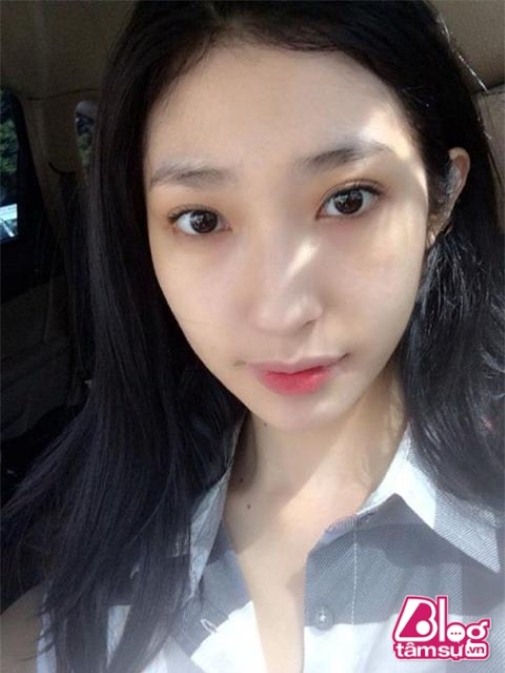 miule blogtamsuvn (3) (Custom)