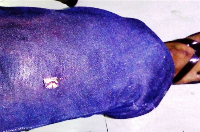 Công an nổ súng làm 1 người chết, điều tra vụ nổ súng làm chết người ở Sài Gòn, làm rõ vụ nổ súng làm chết người