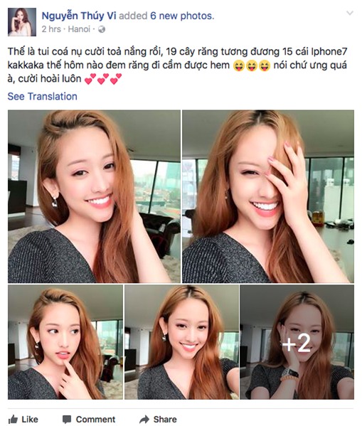 Thuý Vi khoe đi làm lại 19 cái răng với giá 250 triệu - Ảnh 2.