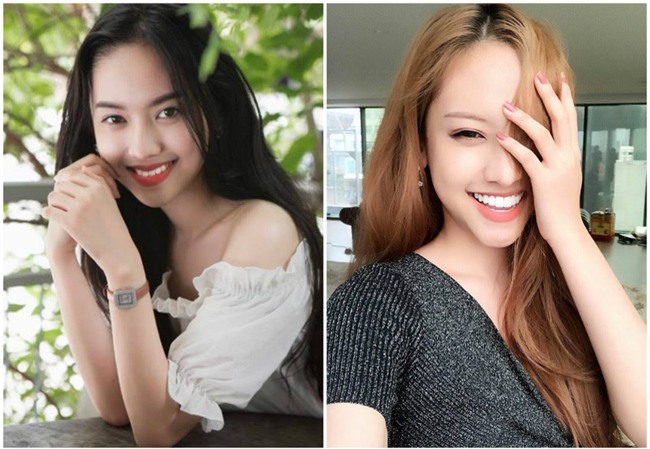 Thuý Vi khoe đi làm lại 19 cái răng với giá 250 triệu - Ảnh 6.