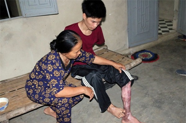 Rơi nước mắt hoàn cảnh chàng trai bị tai nạn mất tay, vợ bỏ đi, một mình chăm con thơ khát sữa - Ảnh 3.