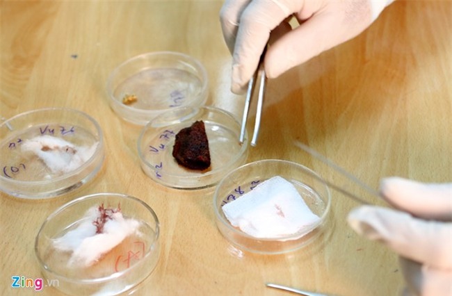 Bac si phap y: Nghe doi mat voi am anh hinh anh 2