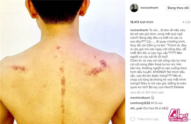 tran thanh blogtamsuvn (15)