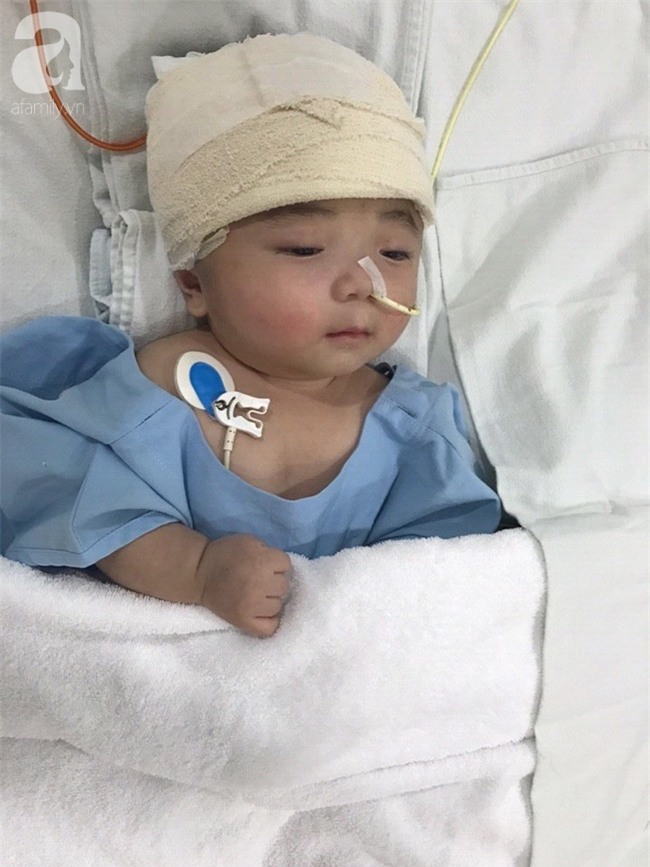 Một ngày sau cuộc tiểu phẫu, em bé não úng thuỷ Phạm Đức Lộc đã biết mở mắt, cử động tay chân - Ảnh 3.