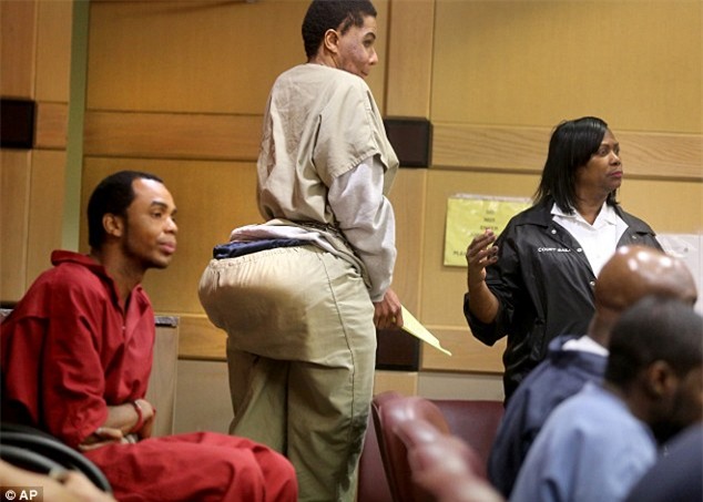 Độn mông bằng xi măng cho khách hàng, gã lang băm trả giá 10 năm tù - Ảnh 1.