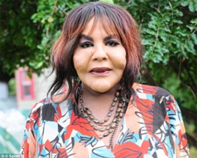 Độn mông bằng xi măng cho khách hàng, gã lang băm trả giá 10 năm tù - Ảnh 2.