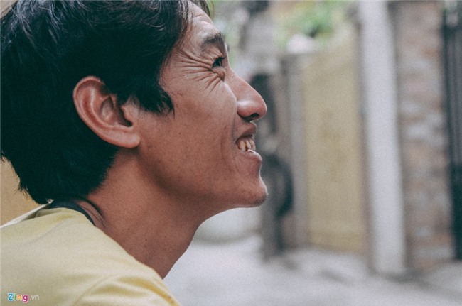 Tieu thuong ngoai tinh lo mat viec khi cho coc bi dep hinh anh 9