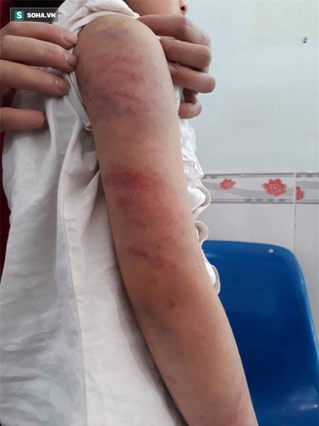 Bố say rượu liên tục đánh, đạp vào bụng con gái 9 tuổi ở Vĩnh Phúc - Ảnh 2.