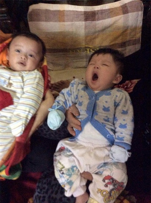 nhung hinh anh moi nhat ve cap song sinh tu tinh trung nguoi bo da mat - 1