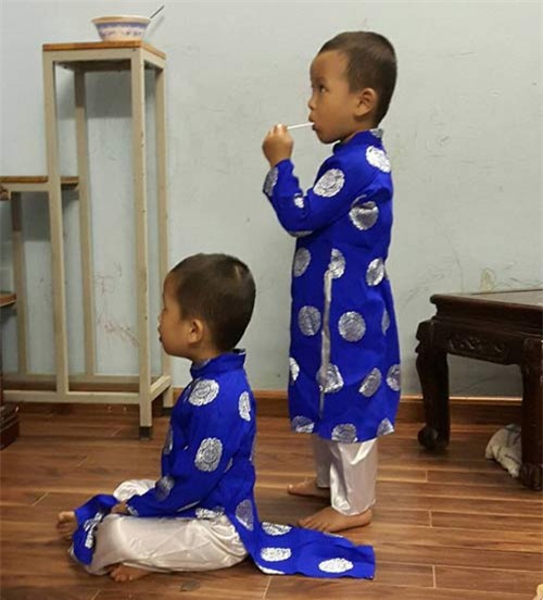 nhung hinh anh moi nhat ve cap song sinh tu tinh trung nguoi bo da mat - 10